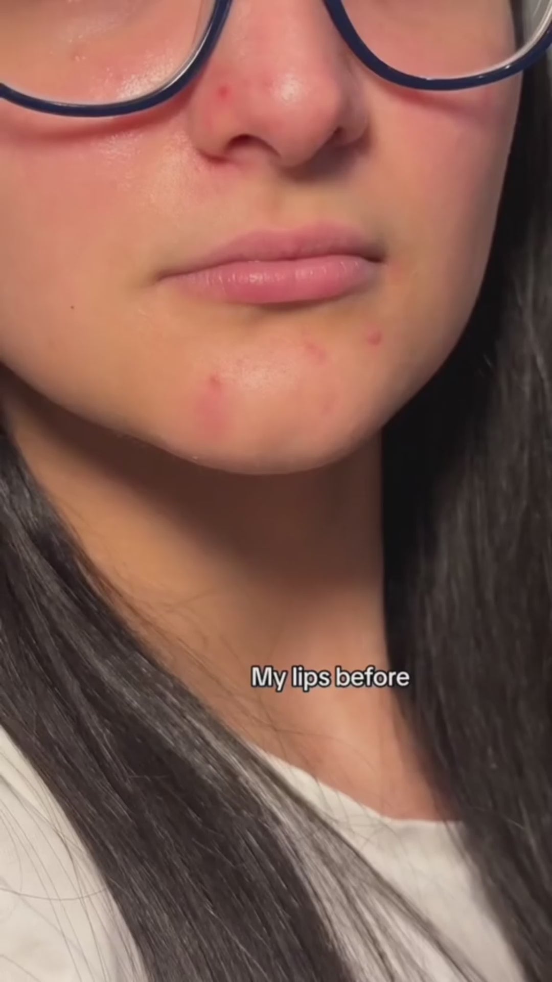 Lip Plumper – Bigger Lips in Minutes